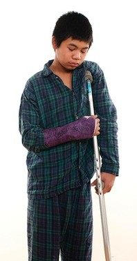 Childrens Injuries Childrens Injuries