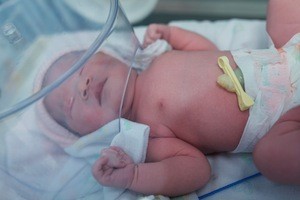 birth-injuries1 birth iinjuries